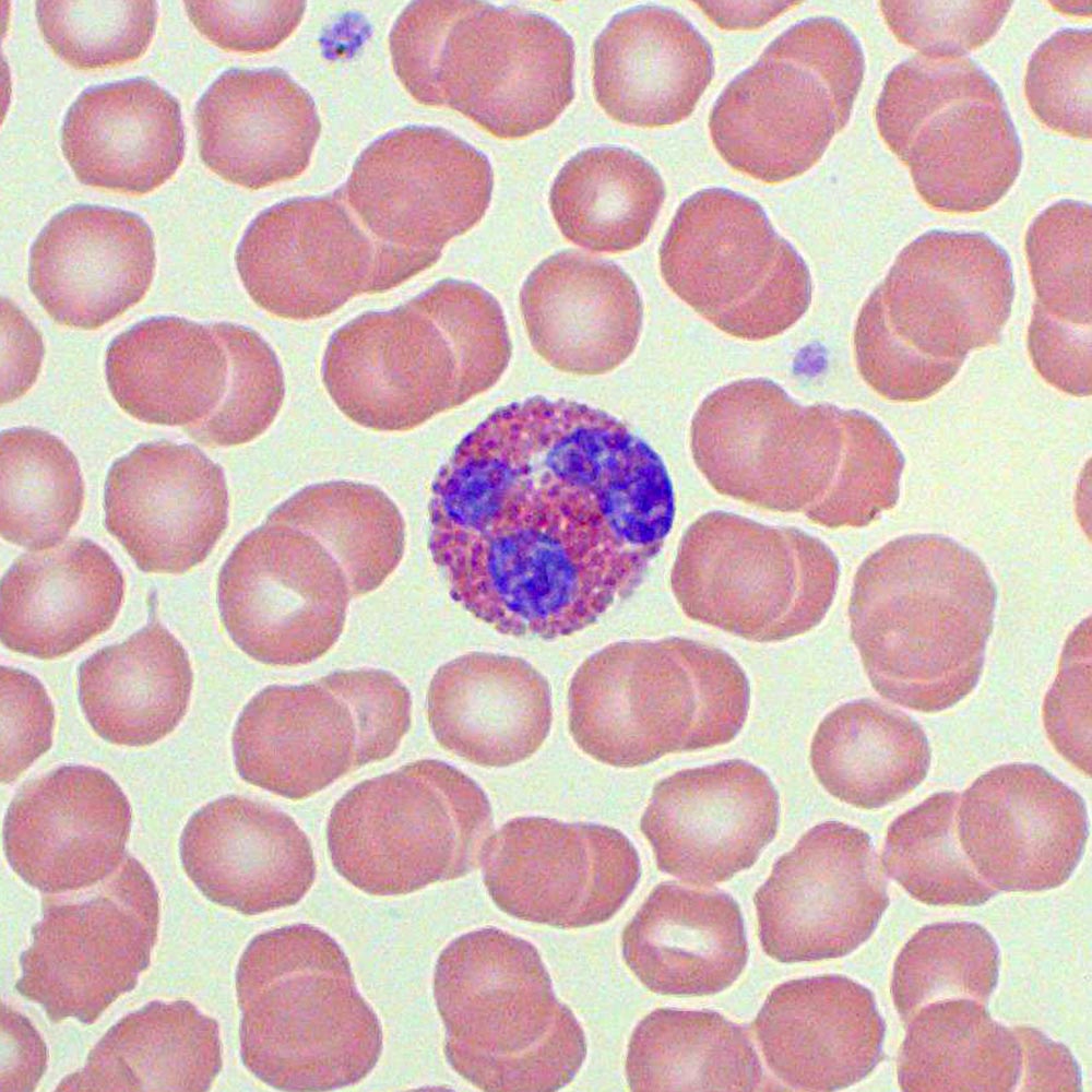 eosinophils-blood-film-medschool