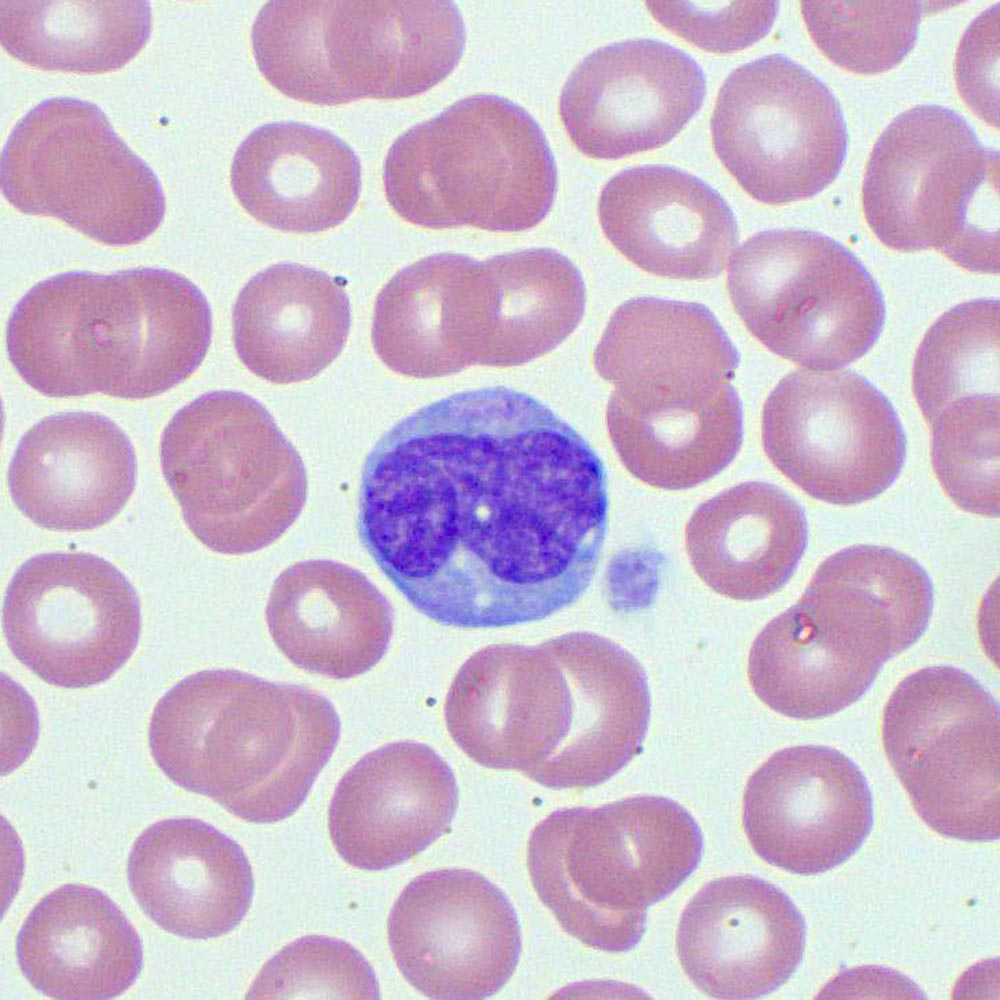 Monocytes | Blood Film - MedSchool