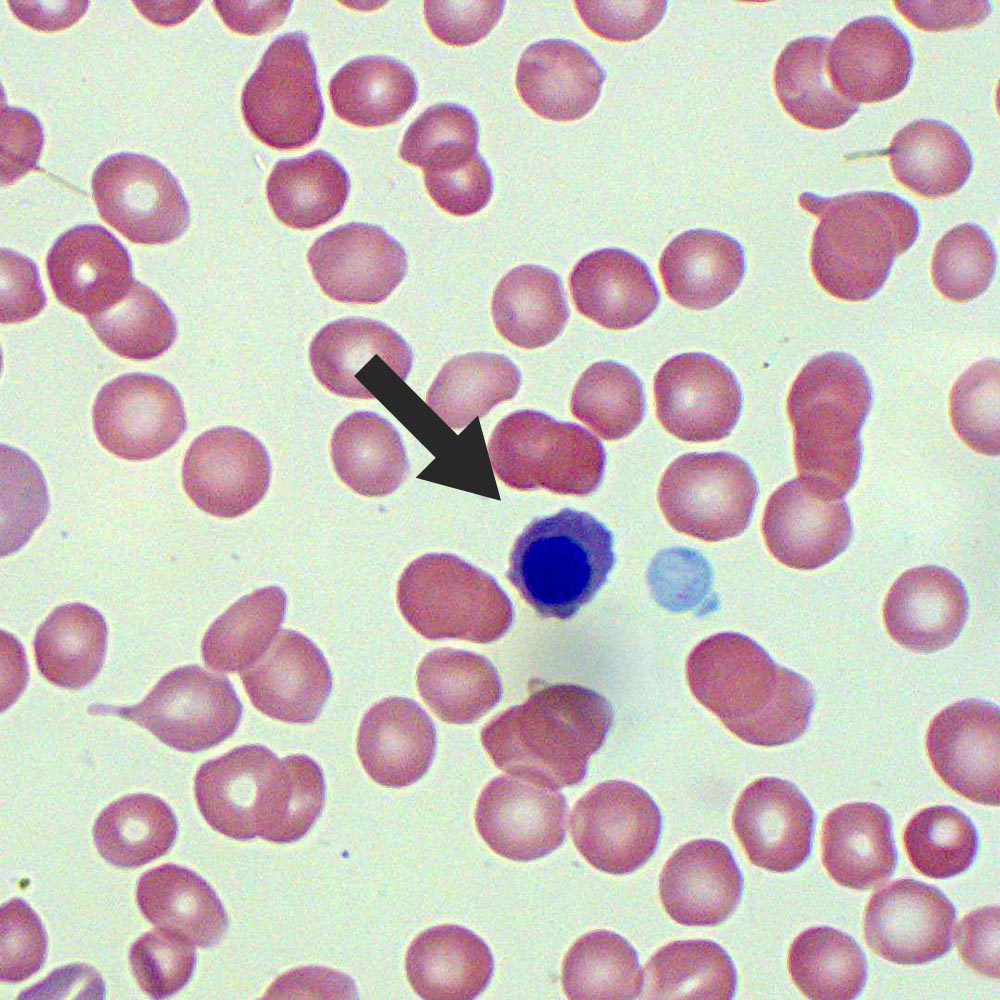 Red Cells | Blood - MedSchool