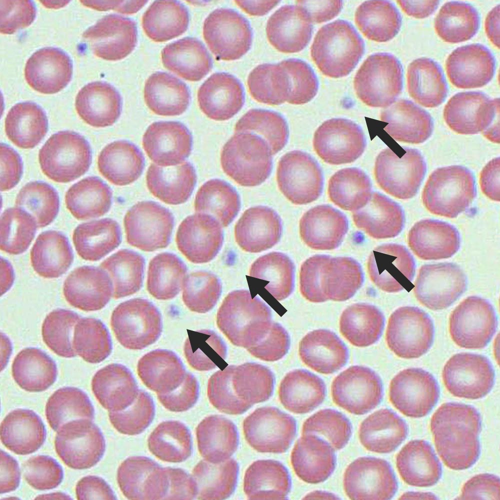 platelets microscope