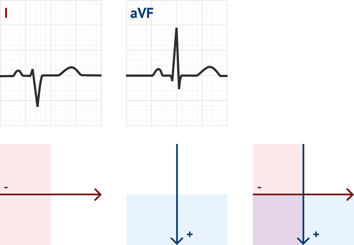 ekg axis