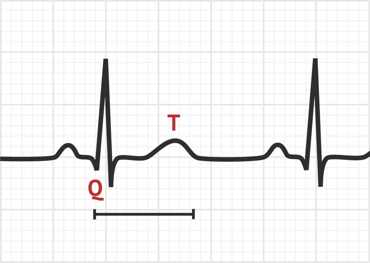 qtc normal range