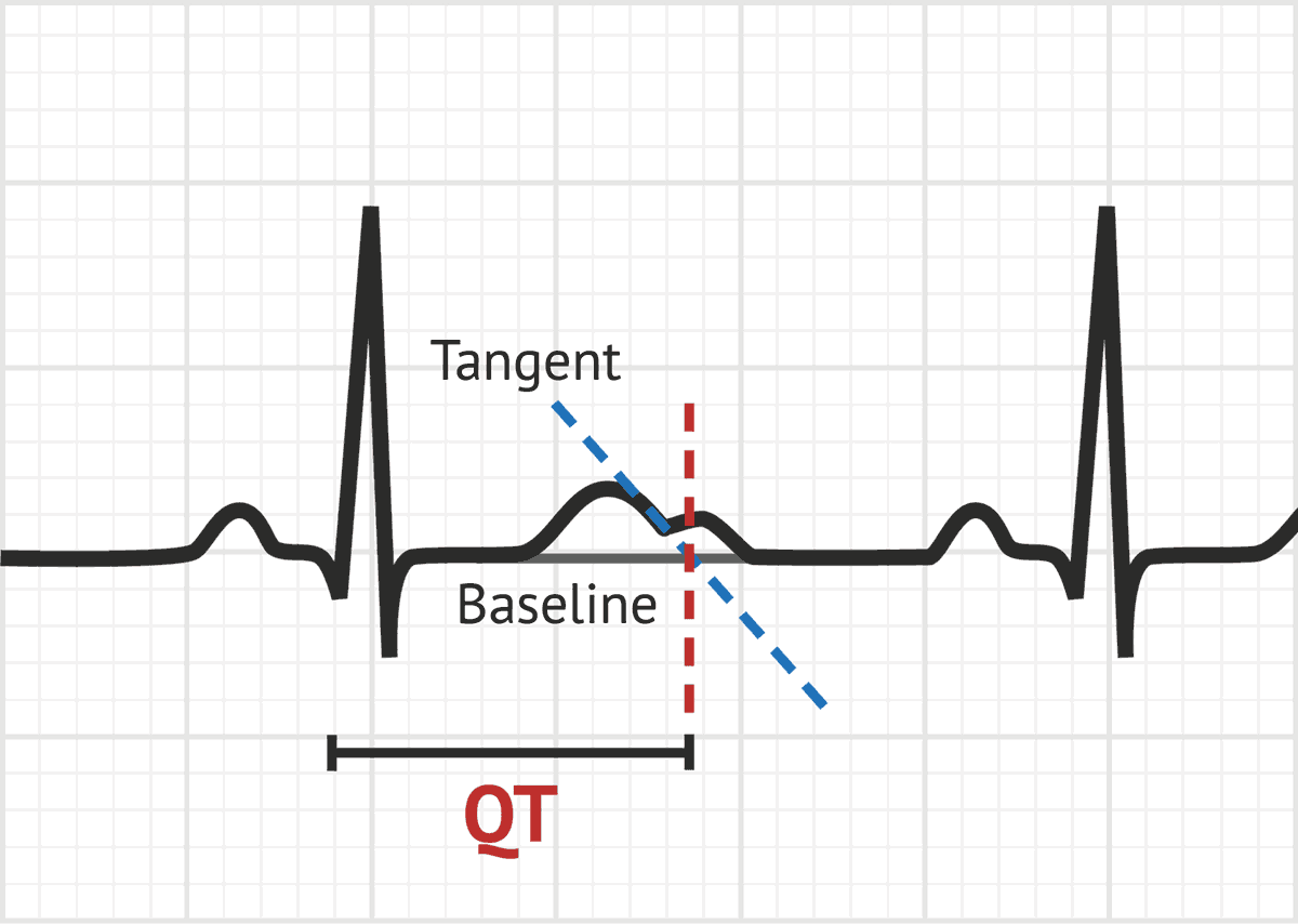 qtc normal range