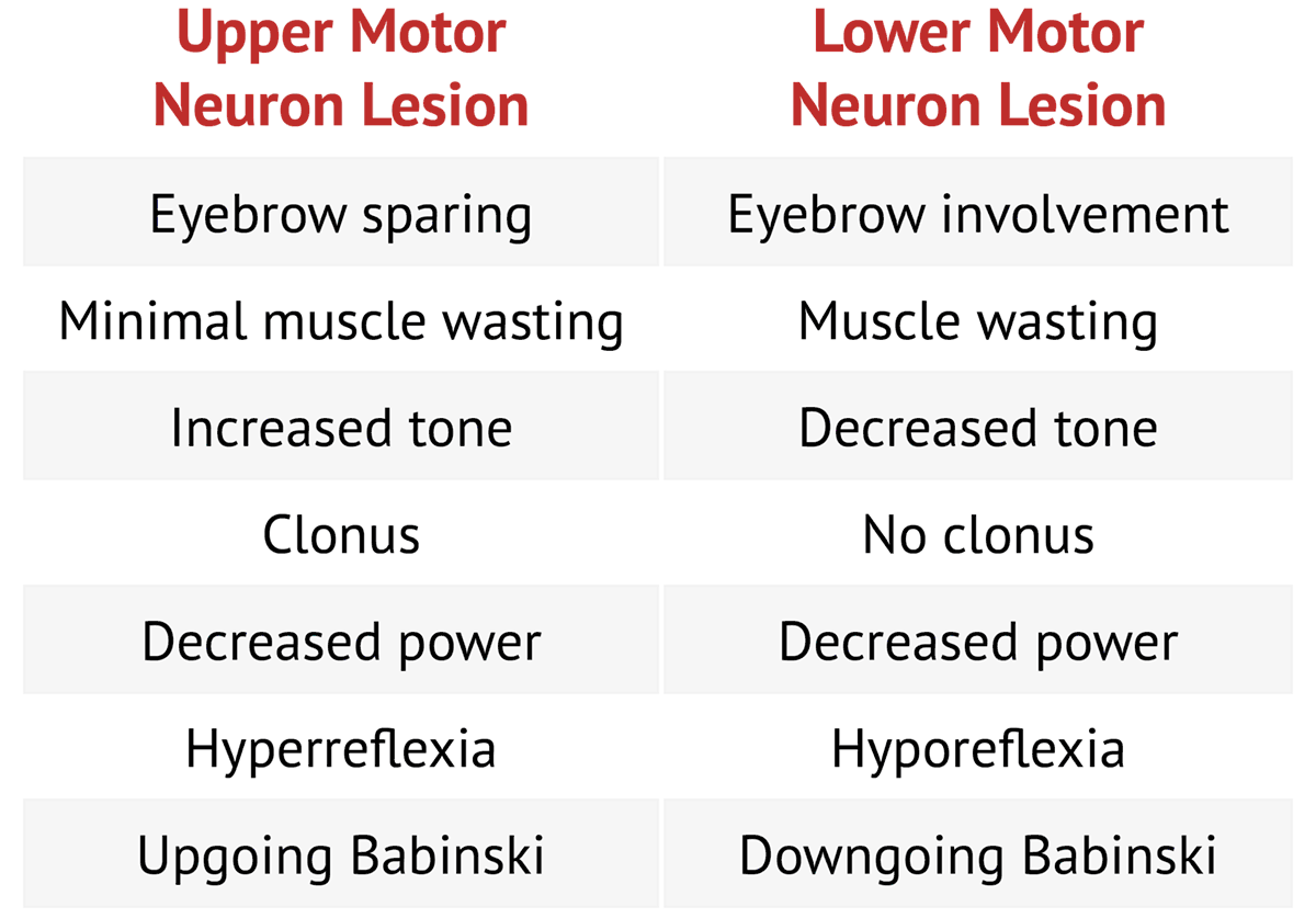 Upper Motor Neuron Lesion Of Nerve Symptoms - Infoupdate.org